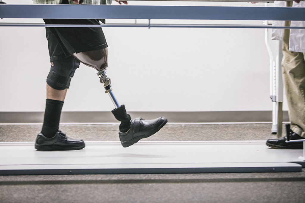 Take a look at some of our most recent accomplishments in the field of prosthetics.