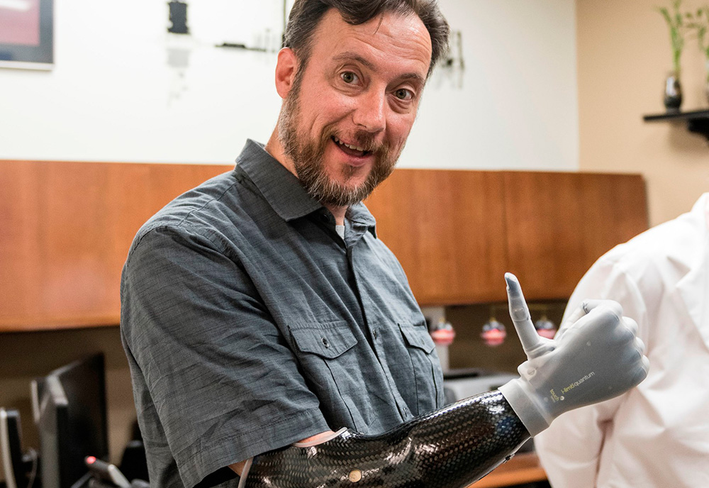 Veteran Daniel Glanz and his high-tech prosthetic robotic hand