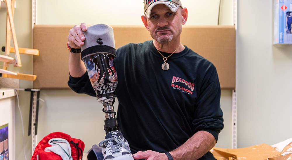 Man holding prosthetic leg