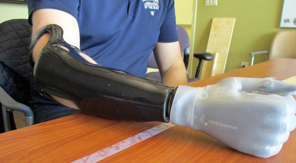Veteran with lower-limb prosthetic device myoelectric arm