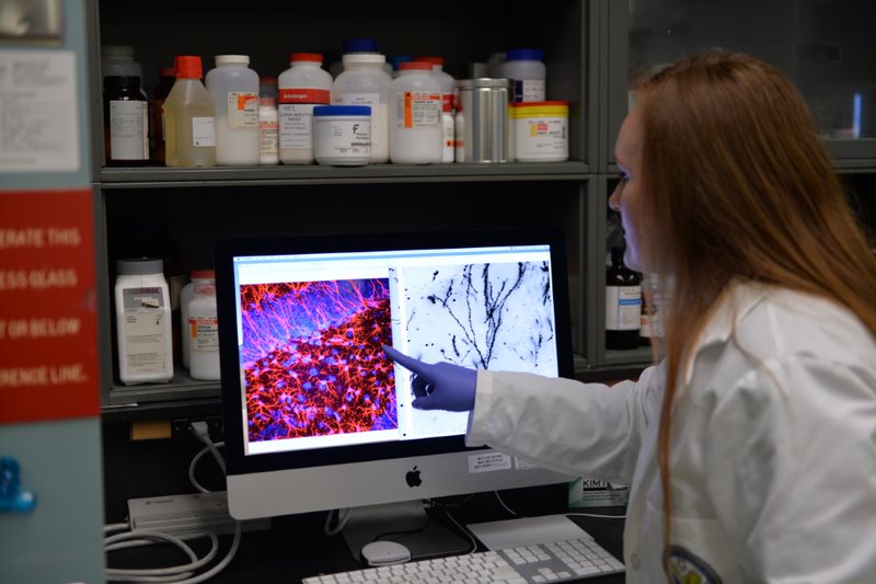 Dr. Whitney Ratliff, who carried out the experiments and analyzed the data in the study, points to injured brain cells in the hippocampus, an important memory center in the brain.