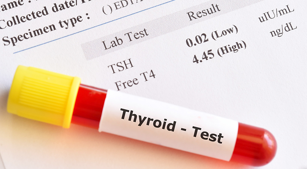 Test tube labeled Thyroid – Test