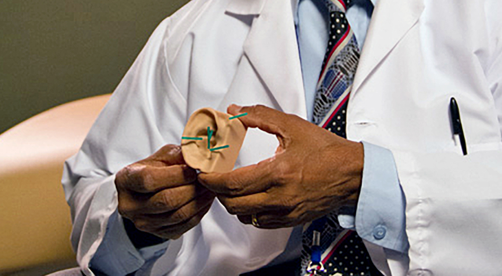 Doctor showing an example of an auricular slant.