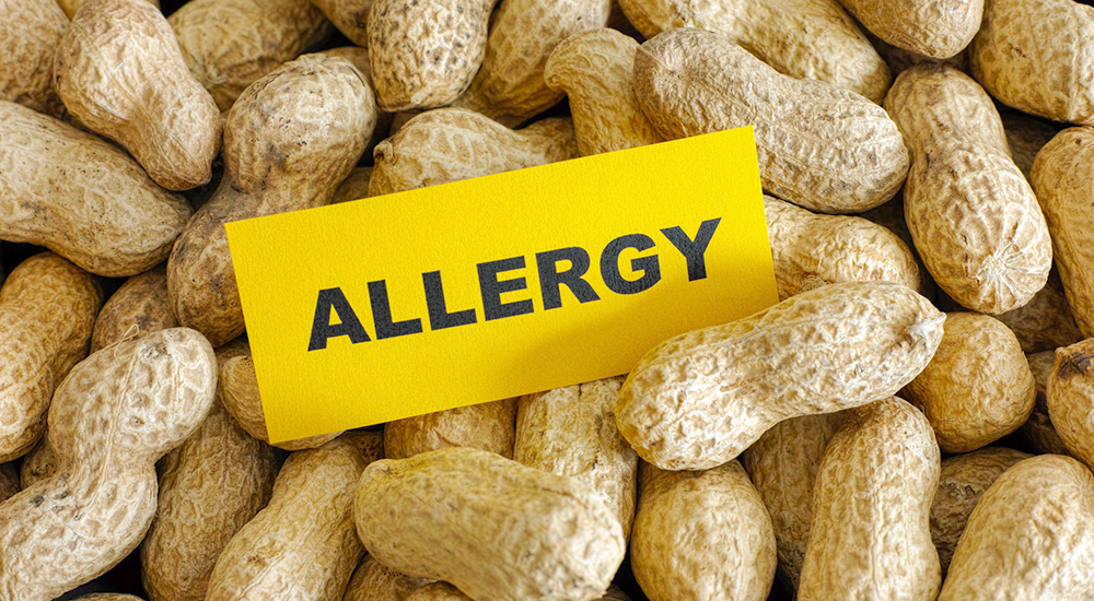 Picture of peanuts with Allergy sign