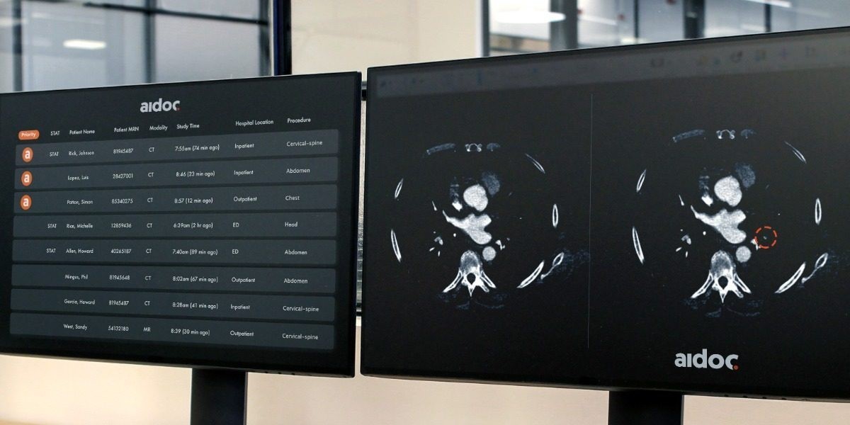 Piloting AI tools for radiologists to deliver the best care to Veterans