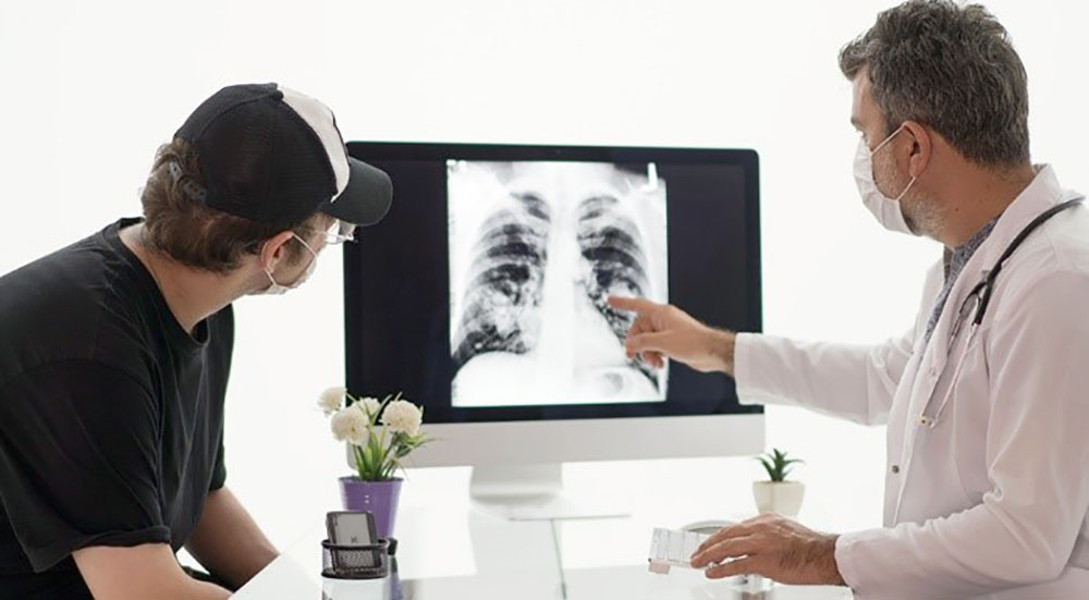 Doctor and patient look at x-ray during lung cancer screening