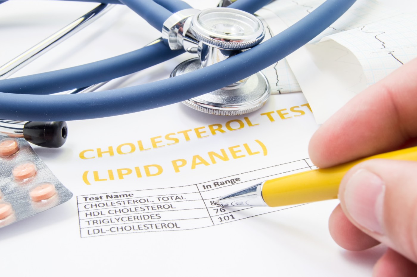 A VA study has documented a link between cholesterol-lowering statin drugs and diabetes progression.