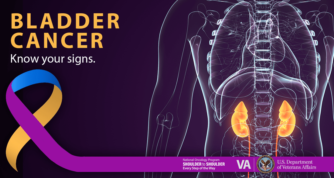 Bladder Cancer and Veterans: What You Need to Know