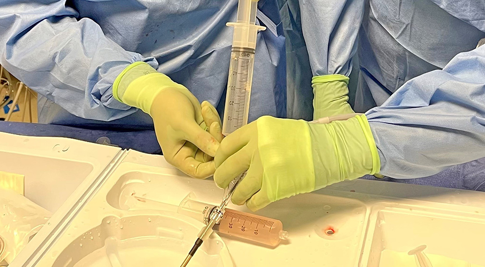 Doctors’ hands preparing Amulet surgical catheter
