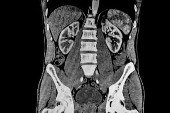 A CT scan of the abdomen.