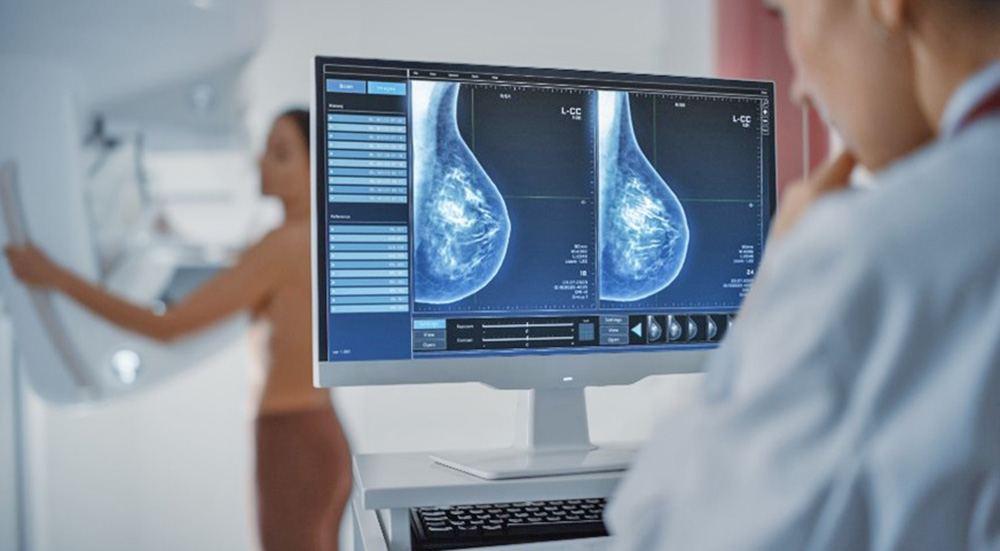 Mammogram provided by the SERVICE Act