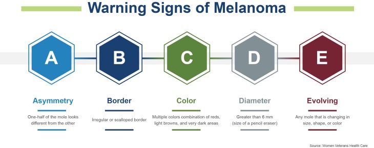 Melanoma infographic. 