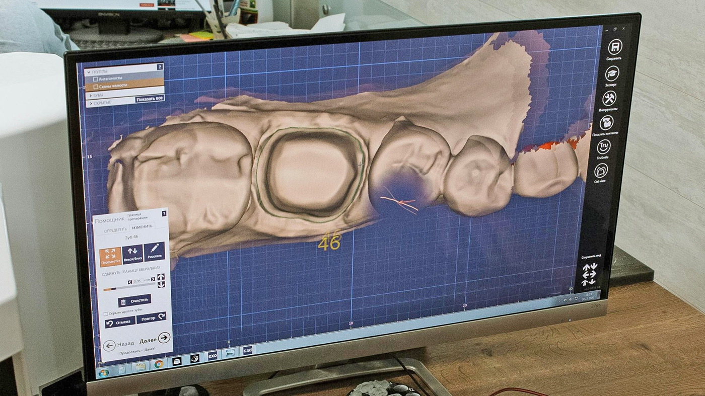 Dental X-ray; dentures