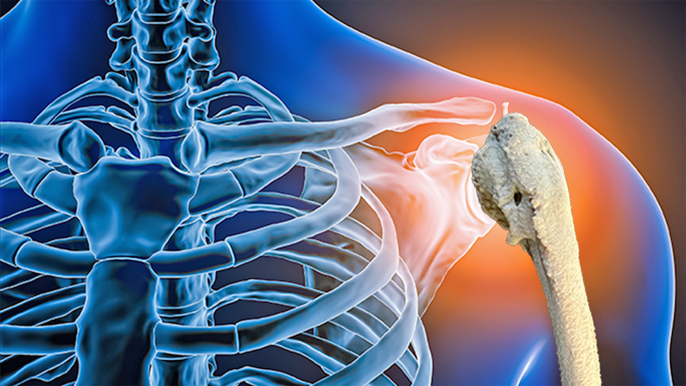 Continue reading Impact of a 3D-printed shoulder model for Veterans